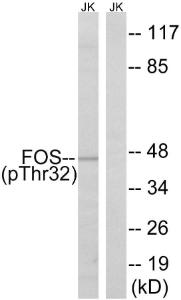 Western blot analysis of lysates from Jurkat cells treated with starved 24h using Anti-FOS (phospho Ser32) Antibody The right hand lane represents a negative control, where the antibody is blocked by the immunising peptide