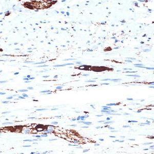 Immunohistochemistry analysis of paraffin-embedded human appendix tissue using Anti-alpha Internexin Antibody [ARC2054] (A305822) at a dilution of 1:100 (40x lens). Perform microwave antigen retrieval with 10 mM Tris/EDTA buffer pH 9.0 before commencing with IHC staining protocol.