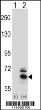 Anti-BBS4 Rabbit Polyclonal Antibody