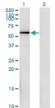 Anti-FGFR1OP Mouse Monoclonal Antibody [clone: 1E8]