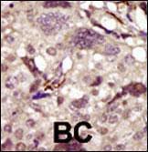 Anti-BTK Rabbit Polyclonal Antibody (Biotin)