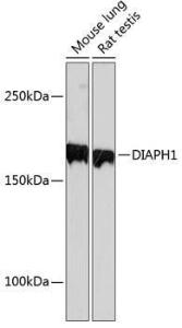 Western blot analysis of extracts of various cell lines, using Anti-DIAPH1 Antibody [ARC0639] (A81067) at 1:1,000 dilution The secondary antibody was Goat Anti-Rabbit IgG H&L Antibody (HRP) at 1:10,000 dilution Lysates/proteins were present at 25 µg per lane