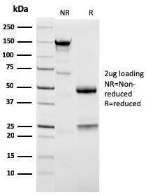 SDS-PAGE analysis of Anti-NAPSIN A Antibody [NAPSA/3309] under non-reduced and reduced conditions; showing intact IgG and intact heavy and light chains, respectively. SDS-PAGE analysis confirms the integrity and purity of the antibody.