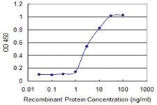 Anti-FGFR1OP Mouse Monoclonal Antibody [clone: 1E8]