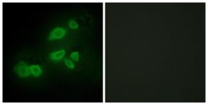 Immunofluorescence analysis of HepG2 cells using Anti-CDCP1 Antibody. The right hand panel represents a negative control, where the antibody was pre-incubated with the immunising peptide