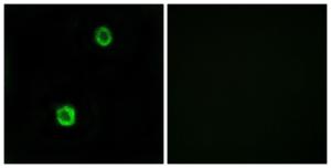 Immunofluorescence analysis of MCF7 cells using Anti-CST1 Antibody. The right hand panel represents a negative control, where the antibody was pre-incubated with the immunising peptide