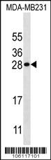 Anti-KLK7 Rabbit Polyclonal Antibody