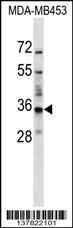 Anti-BATF2 Rabbit Polyclonal Antibody (AP (Alkaline Phosphatase))