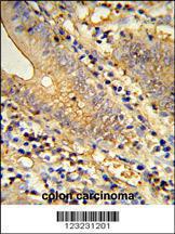 Anti-TSPAN33 Rabbit Polyclonal Antibody (FITC (Fluorescein Isothiocyanate))