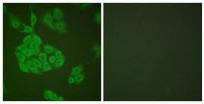 Anti-MMP11 Rabbit Polyclonal Antibody