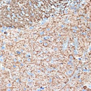 Immunohistochemistry analysis of paraffin-embedded mouse brain using Anti-alpha Internexin Antibody [ARC2054] (A305822) at a dilution of 1:100 (40x lens). Perform microwave antigen retrieval with 10 mM Tris/EDTA buffer pH 9.0 before commencing with IHC staining protocol.