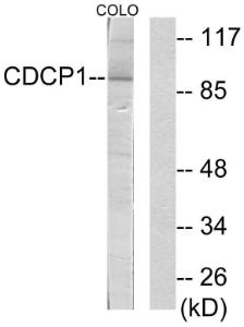 Western blot analysis of lysates from COLO205 cells using Anti-CDCP1 Antibody. The right hand lane represents a negative control, where the antibody is blocked by the immunising peptide