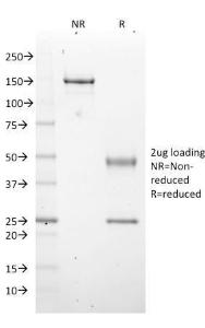 SDS-PAGE analysis of Anti-EZH2 Antibody [EZH2/2536] under non-reduced and reduced conditions; showing intact IgG and intact heavy and light chains, respectively. SDS-PAGE analysis confirms the integrity and purity of the antibody