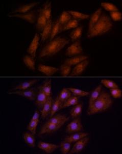 Immunofluorescence analysis of H9C2 cells using Anti-ECSIT Antibody (A10226) at dilution of 100 (40x lens). DAPI was used to stain the cell nuclei (blue).