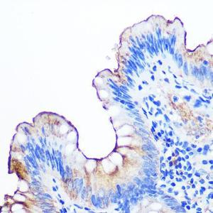 Immunohistochemistry analysis of paraffin-embedded human appendix tissue using Anti-CEACAM1 Antibody [ARC0649] (A81072) at a dilution of 1:100 (40X lens). Perform microwave antigen retrieval with 10 mM PBS buffer pH 7.2 before commencing with IHC staining protocol