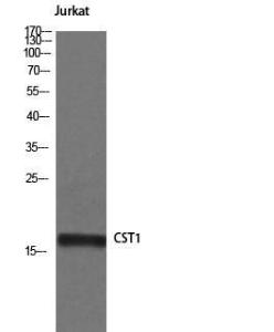 Western blot analysis of Jurkat cells using Anti-CST1 Antibody