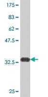 Anti-HRASLS Mouse Polyclonal Antibody