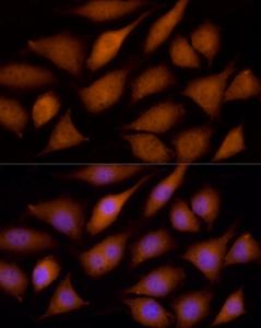 Immunofluorescence analysis of L929 cells using Anti-ECSIT Antibody (A10226) at dilution of 100 (40x lens). DAPI was used to stain the cell nuclei (blue).