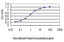 Anti-ROBO1 Mouse Monoclonal Antibody [clone: 2G6]