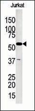 Anti-GK2 Rabbit Polyclonal Antibody (APC (Allophycocyanin))