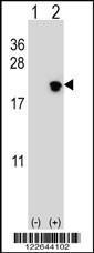 Anti-NIP7 Rabbit Polyclonal Antibody (APC (Allophycocyanin))