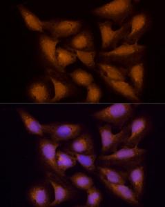 Immunofluorescence analysis of U2OS cells using Anti-ECSIT Antibody (A10226) at dilution of 100 (40x lens). DAPI was used to stain the cell nuclei (blue).