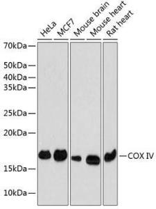 Anti-COX IV Rabbit Monoclonal Antibody [clone: ARC2518]