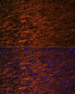 Immunofluorescence analysis of rat brain using Anti-alpha Internexin Antibody [ARC2054] (A305822) at a dilution of 1:100 (40x lens). DAPI was used to stain the cell nuclei (blue).