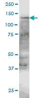 Anti-ERN1 Mouse Monoclonal Antibody [clone: 4E1]