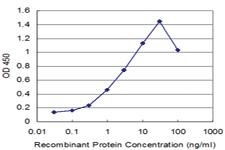 Anti-ROBO1 Mouse Monoclonal Antibody [clone: 1F8]