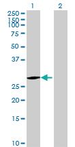 Anti-EMG1 Mouse Polyclonal Antibody