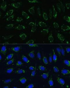 Immunofluorescence analysis of U-2 OS cells using Anti-NDUFA4 Antibody (A307518) at a dilution of 1:100 (40x lens). DAPI was used to stain the cell nuclei (blue).