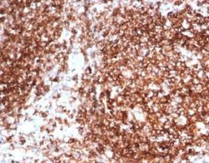 Immunohistochemical analysis of formalin-fixed, paraffin-embedded human tonsil tissue using Anti-HLA DP + DQ + DR Antibody [HLA-Pan/6663]