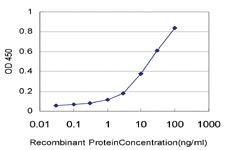 Anti-ERN1 Mouse Monoclonal Antibody [clone: 4E1]