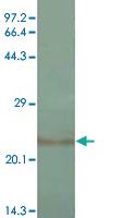 Anti-IL1B Mouse Monoclonal Antibody [clone: 2H12]