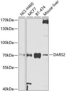 Western blot analysis of extracts of various cell lines, using Anti-DARS2 Antibody (A10227) at 1:1,000 dilution. The secondary antibody was Goat Anti-Rabbit IgG H&L Antibody (HRP) at 1:10,000 dilution.