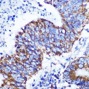 Anti-COX IV Rabbit Monoclonal Antibody [clone: ARC2518]