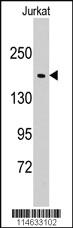 Anti-TOP1 Rabbit Polyclonal Antibody