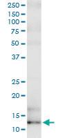 Anti-SAA4 Polyclonal Antibody Pair