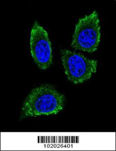 Anti-MMP12 Rabbit Polyclonal Antibody (Biotin)