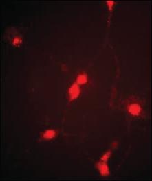 Anti-CLCN4 Rabbit Polyclonal Antibody