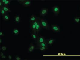 Anti-TAF11 Mouse Monoclonal Antibody [clone: 3G6]