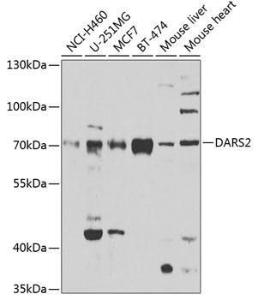 Western blot analysis of extracts of various cell lines, using Anti-DARS2 Antibody (A10227) at 1:1,000 dilution. The secondary antibody was Goat Anti-Rabbit IgG H&L Antibody (HRP) at 1:10,000 dilution.