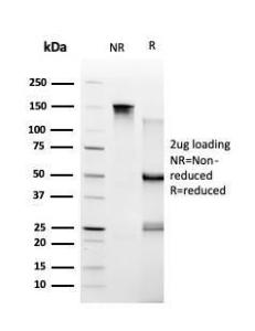 SDS-PAGE analysis of Anti-TRBP Antibody [PCRP-TARBP2-1E5] under non-reduced and reduced conditions; showing intact IgG and intact heavy and light chains, respectively SDS-PAGE analysis confirms the integrity and purity of the antibody