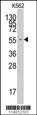 Anti-FARSA Rabbit Polyclonal Antibody