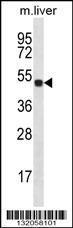 Anti-HOXD10 Rabbit Polyclonal Antibody (APC (Allophycocyanin))