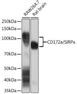 Western blot analysis of extracts of various cell lines, using Anti-SIRP alpha Antibody [ARC1626] (A308467) at 1:1,000 dilution. The secondary antibody was Goat Anti-Rabbit IgG H&L Antibody (HRP) at 1:10,000 dilution.