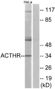 Western blot analysis of lysates from HeLa cells using Anti-ACTHR Antibody. The right hand lane represents a negative control, where the Antibody is blocked by the immunising peptide