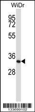 Anti-XPA Rabbit Polyclonal Antibody (FITC (Fluorescein Isothiocyanate))