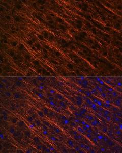 Immunofluorescence analysis of mouse brain using Anti-alpha Internexin Antibody [ARC2054] (A305822) at a dilution of 1:100 (40x lens). DAPI was used to stain the cell nuclei (blue).